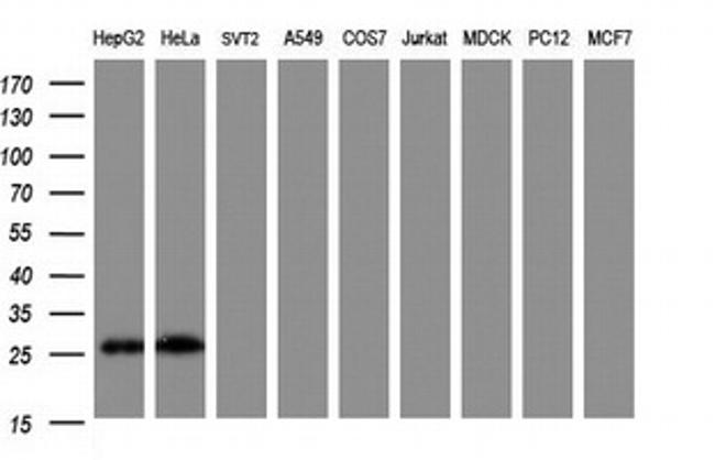 NANP Antibody in Western Blot (WB)