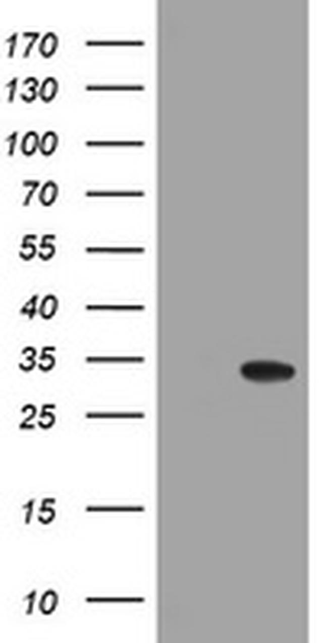 NANP Antibody in Western Blot (WB)