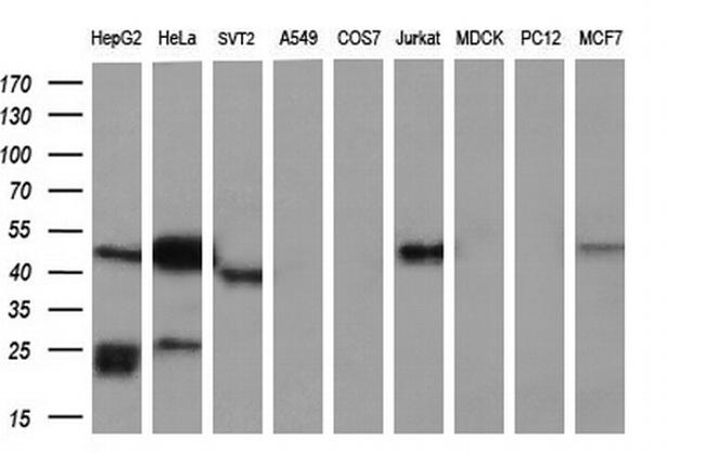 NAPEPLD Antibody in Western Blot (WB)