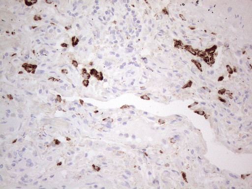 NAPSA Antibody in Immunohistochemistry (Paraffin) (IHC (P))