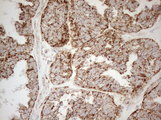 NAPSA Antibody in Immunohistochemistry (Paraffin) (IHC (P))