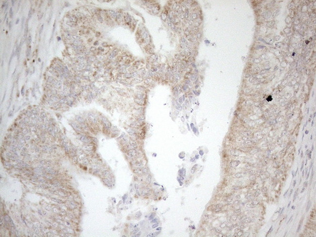 NAPSA Antibody in Immunohistochemistry (Paraffin) (IHC (P))