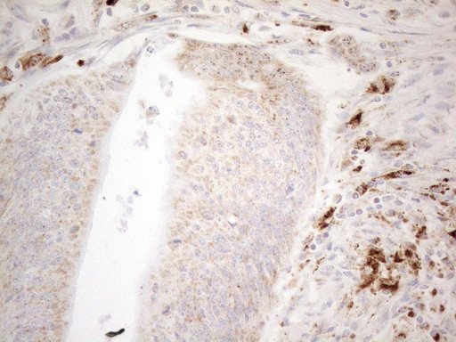 NAPSA Antibody in Immunohistochemistry (Paraffin) (IHC (P))