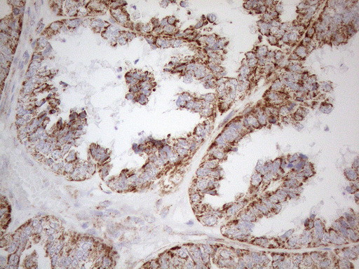 NAPSA Antibody in Immunohistochemistry (Paraffin) (IHC (P))