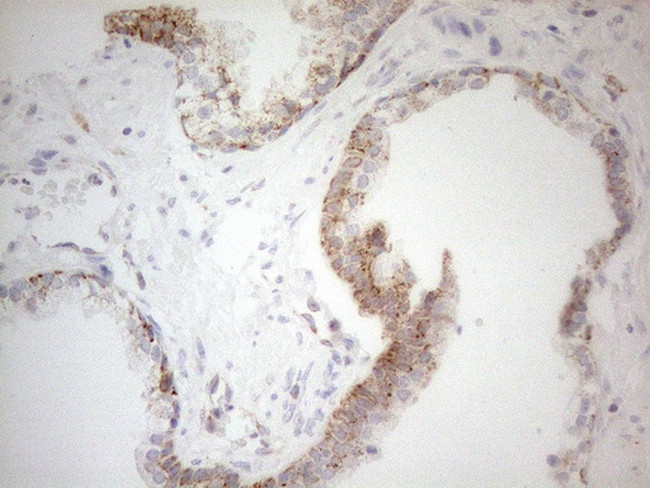 NAPSA Antibody in Immunohistochemistry (Paraffin) (IHC (P))