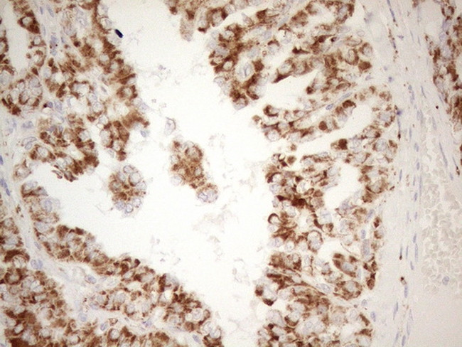 NAPSA Antibody in Immunohistochemistry (Paraffin) (IHC (P))