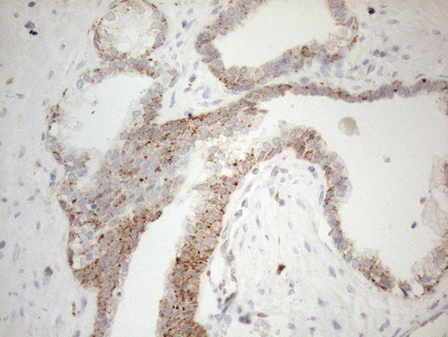 NAPSA Antibody in Immunohistochemistry (Paraffin) (IHC (P))