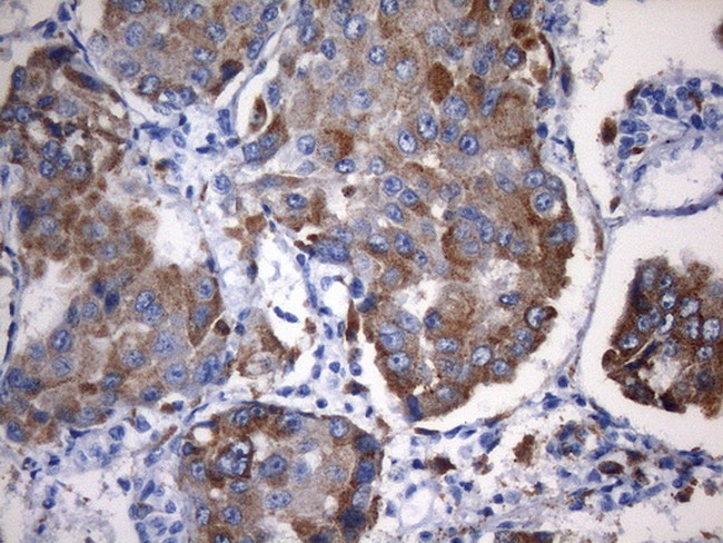 NAPSA Antibody in Immunohistochemistry (Paraffin) (IHC (P))