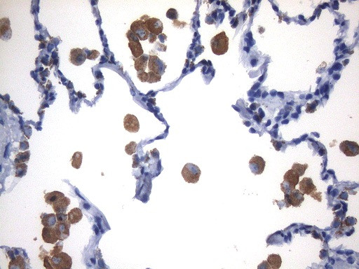 NAPSA Antibody in Immunohistochemistry (Paraffin) (IHC (P))