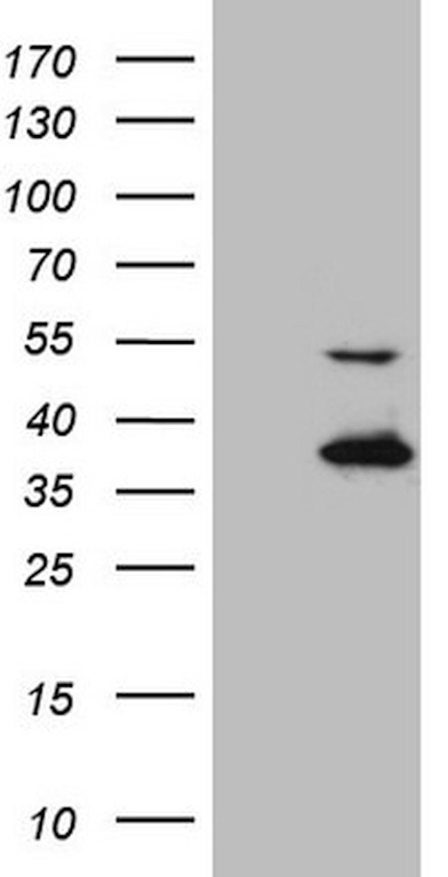 NAPSA Antibody in Western Blot (WB)