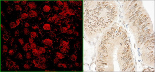 NARG1 Antibody in Immunohistochemistry (IHC)