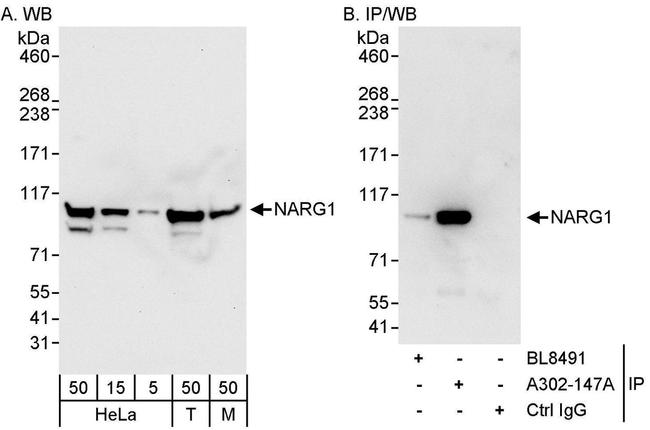 NARG1 Antibody in Western Blot (WB)