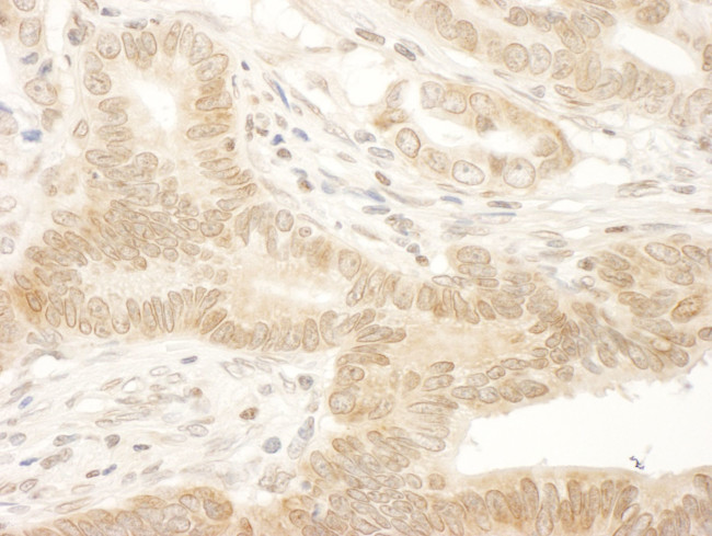 NARG1 Antibody in Immunohistochemistry (IHC)