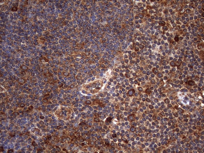 NARS2 Antibody in Immunohistochemistry (Paraffin) (IHC (P))