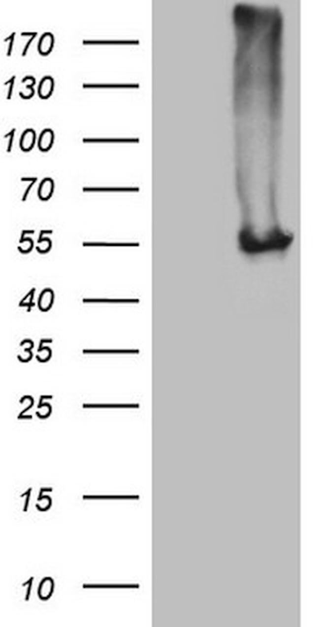 NARS2 Antibody in Western Blot (WB)