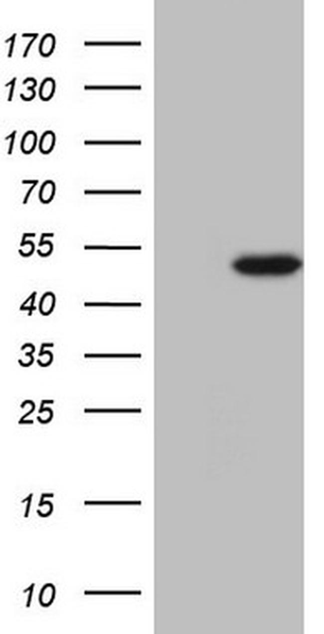 NARS2 Antibody in Western Blot (WB)