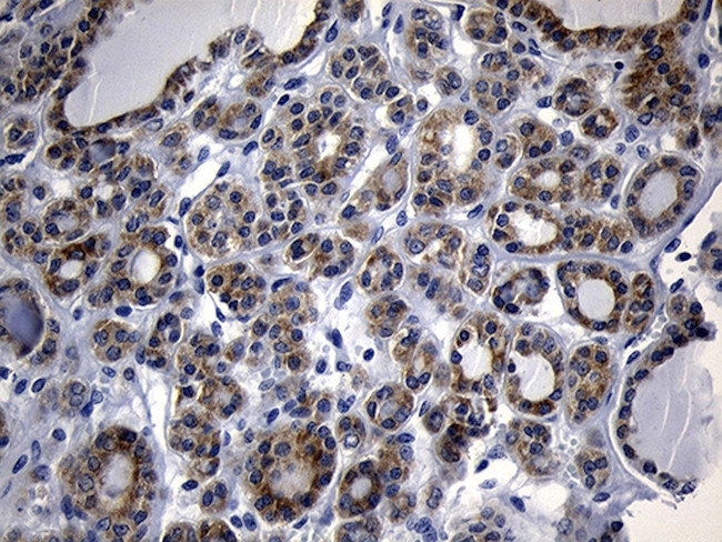 NAT1 Antibody in Immunohistochemistry (Paraffin) (IHC (P))