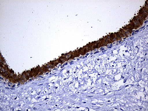 NAT1 Antibody in Immunohistochemistry (Paraffin) (IHC (P))