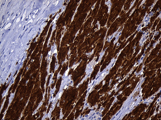 NAT1 Antibody in Immunohistochemistry (Paraffin) (IHC (P))