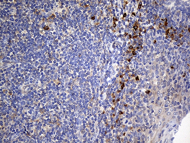 NAT1 Antibody in Immunohistochemistry (Paraffin) (IHC (P))