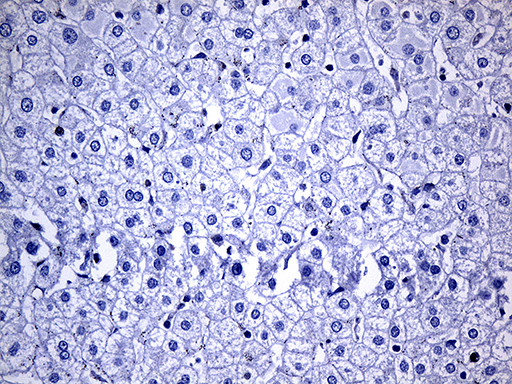 NAT1 Antibody in Immunohistochemistry (Paraffin) (IHC (P))