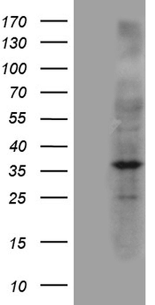 NAT1 Antibody in Western Blot (WB)