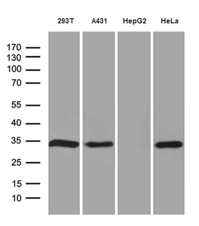 NAT1 Antibody in Western Blot (WB)