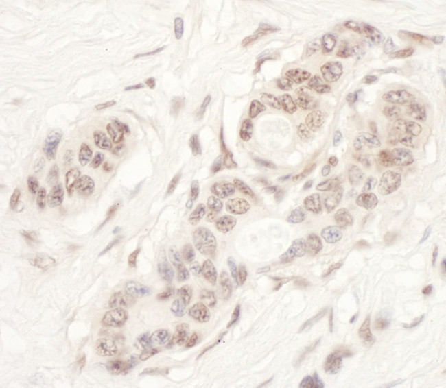 NAT10 Antibody in Immunohistochemistry (IHC)