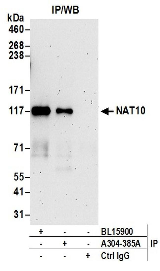 NAT10 Antibody in Western Blot (WB)