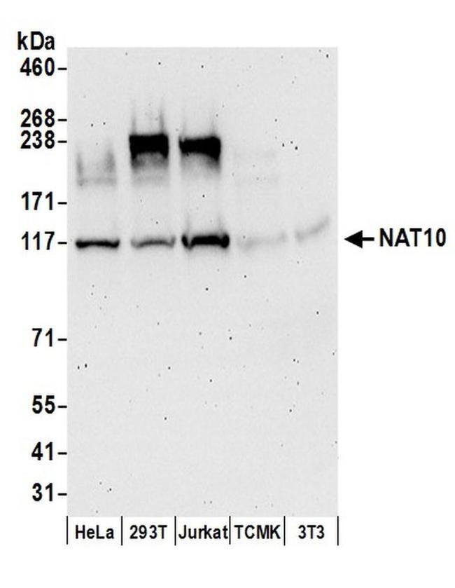 NAT10 Antibody in Western Blot (WB)