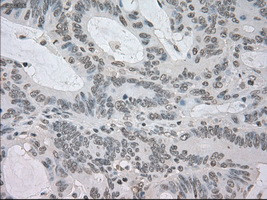 NAT8 Antibody in Immunohistochemistry (Paraffin) (IHC (P))