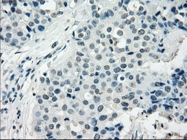 NAT8 Antibody in Immunohistochemistry (Paraffin) (IHC (P))