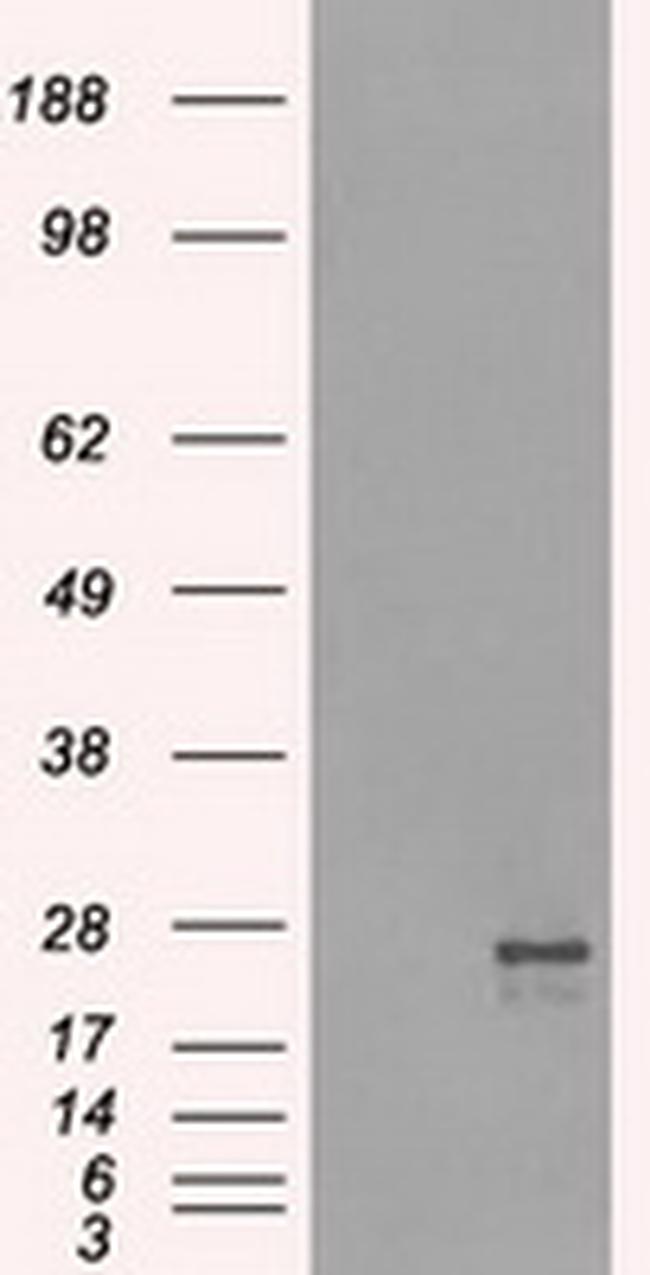 NAT8 Antibody in Western Blot (WB)