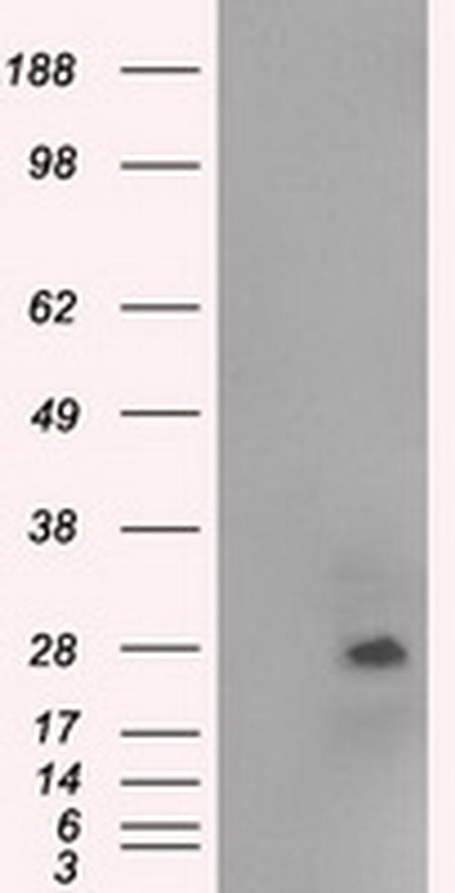 NAT8 Antibody in Western Blot (WB)