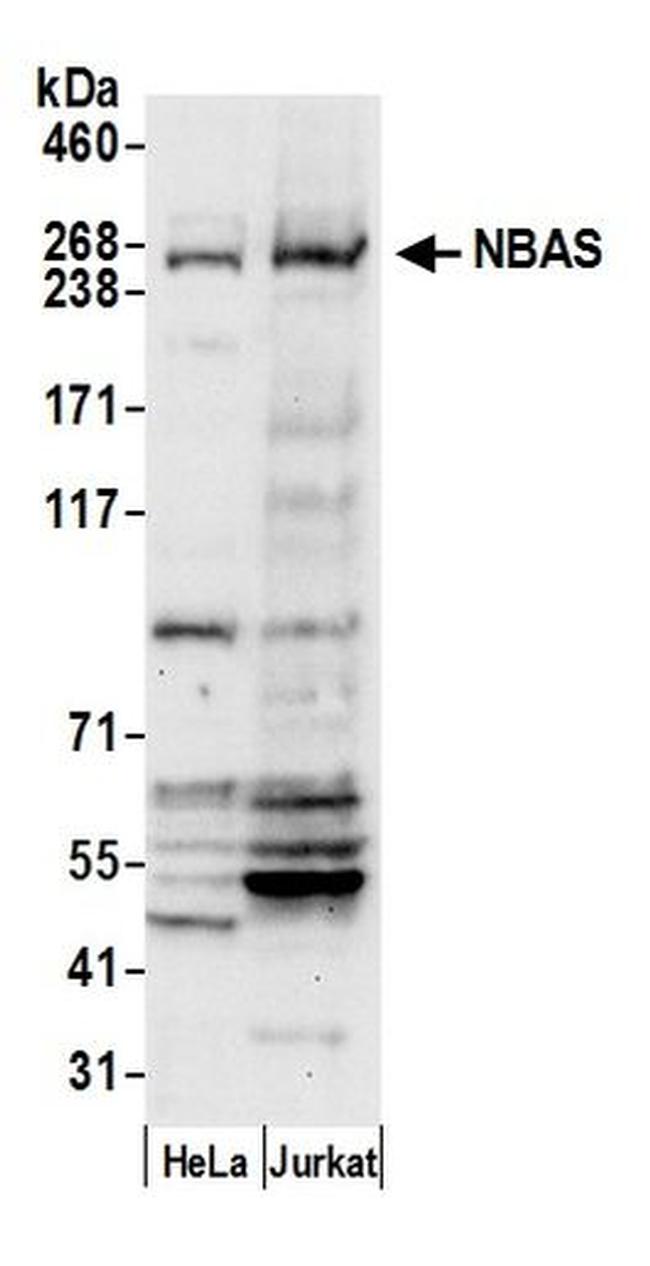 NBAS Antibody in Western Blot (WB)