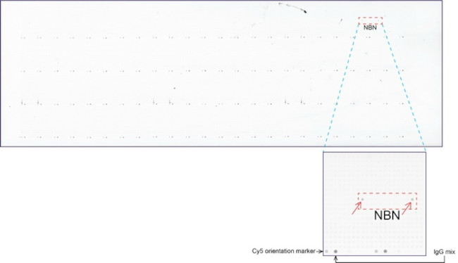 NBN Antibody in Peptide array (ARRAY)