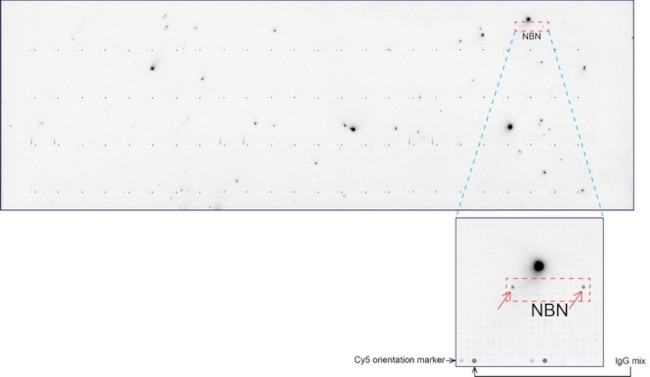 NBN Antibody in Peptide array (ARRAY)