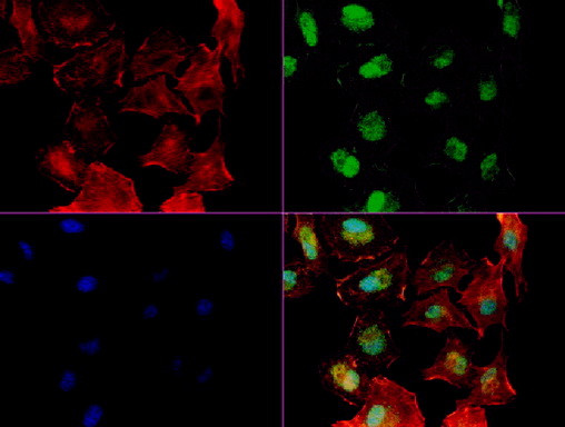 NBN Antibody in Immunocytochemistry (ICC/IF)