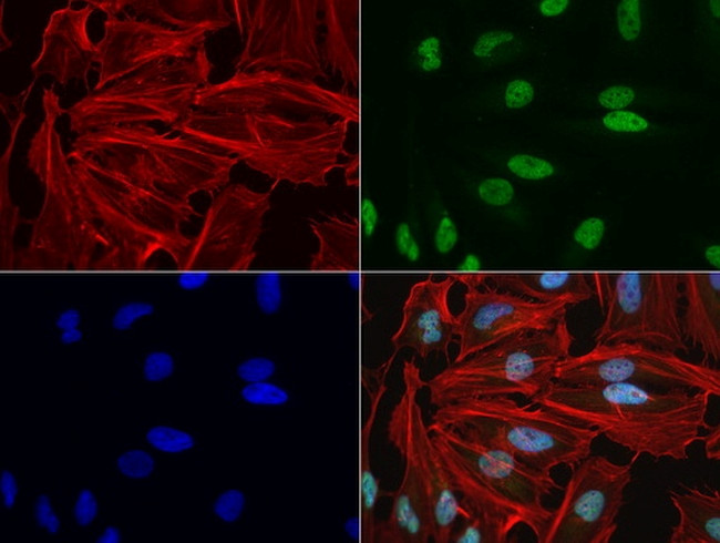 NBN Antibody in Immunocytochemistry (ICC/IF)