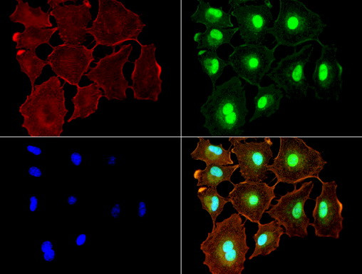 NBN Antibody in Immunocytochemistry (ICC/IF)