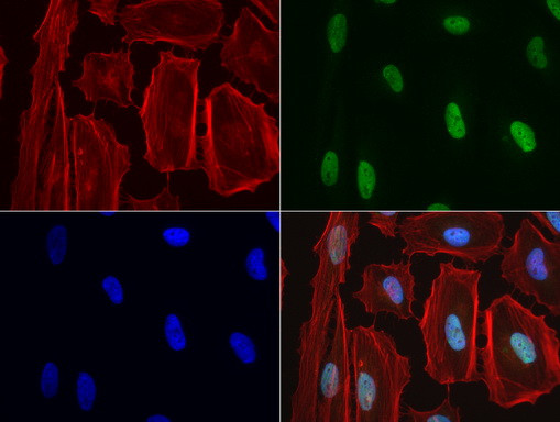 NBN Antibody in Immunocytochemistry (ICC/IF)