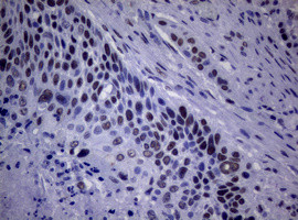 NBN Antibody in Immunohistochemistry (Paraffin) (IHC (P))