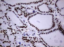 NBN Antibody in Immunohistochemistry (Paraffin) (IHC (P))