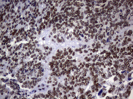 NBN Antibody in Immunohistochemistry (Paraffin) (IHC (P))