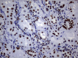 NBN Antibody in Immunohistochemistry (Paraffin) (IHC (P))