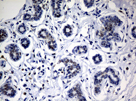 NBN Antibody in Immunohistochemistry (Paraffin) (IHC (P))