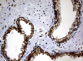 NBN Antibody in Immunohistochemistry (Paraffin) (IHC (P))