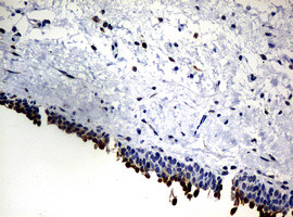 NBN Antibody in Immunohistochemistry (Paraffin) (IHC (P))