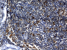 NBN Antibody in Immunohistochemistry (Paraffin) (IHC (P))