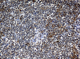 NBN Antibody in Immunohistochemistry (Paraffin) (IHC (P))